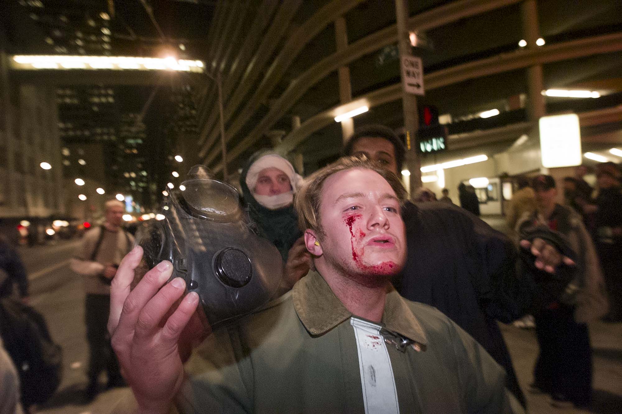 Image of WTO protester with bloodied face, Seattle, November 30, 1999