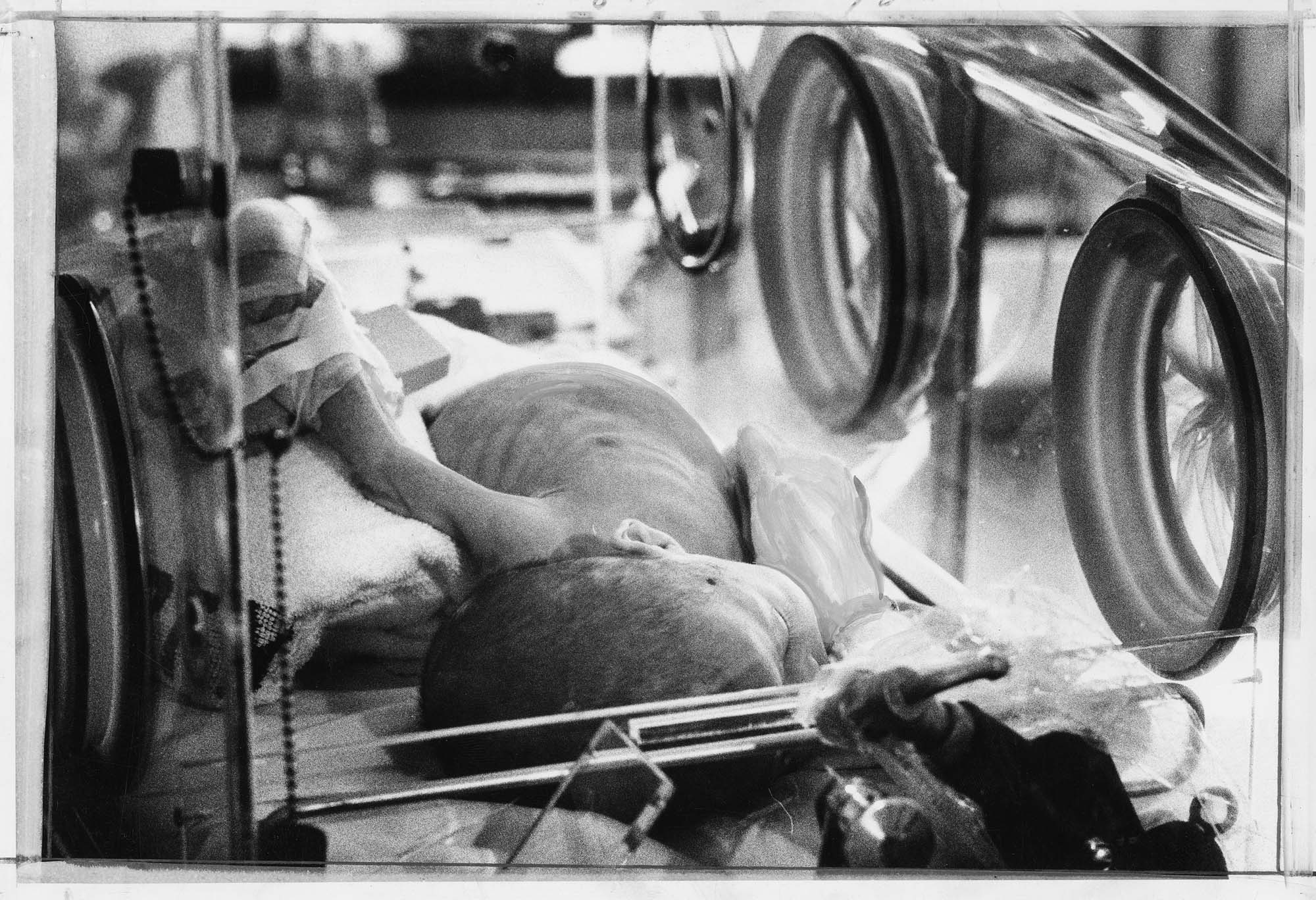 Image of Vietnamese infant at Children's Orthopedic Hospital, Seattle, April 6, 1975